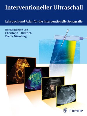 cover image of Interventioneller Ultraschall